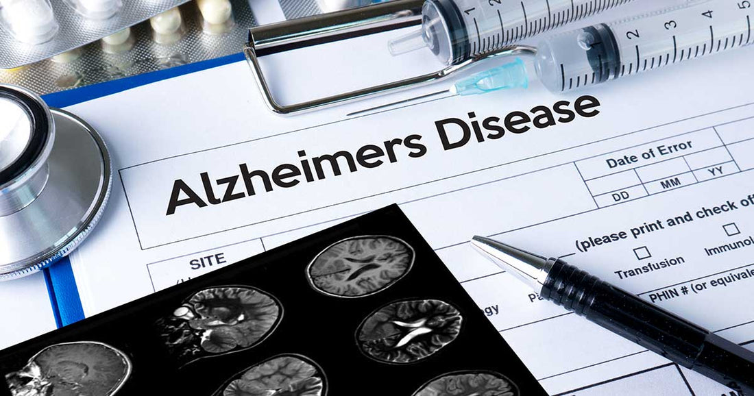 Alzheimer’s and Heavy Metals: Is Detox the Missing Piece